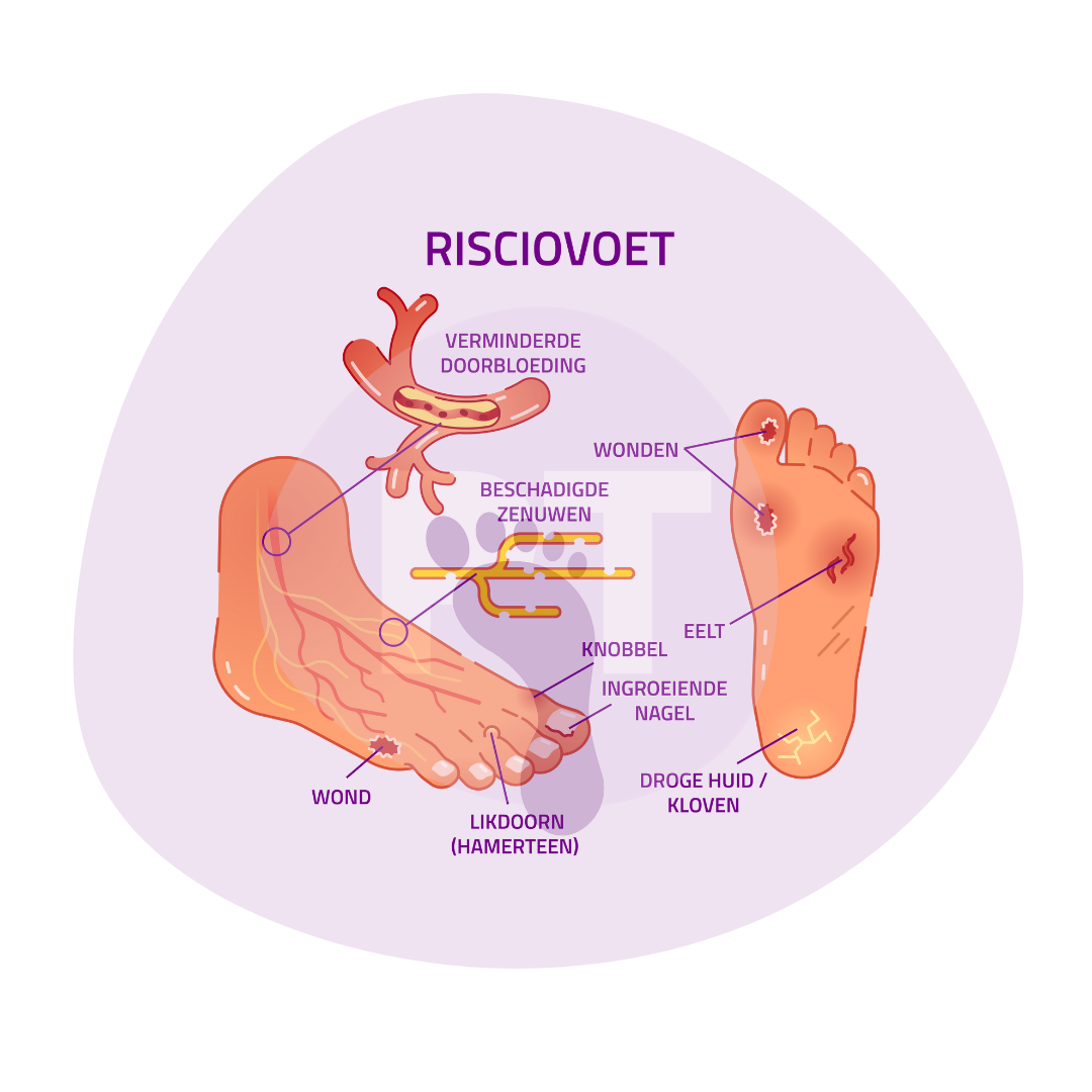 Risicovoet Medisch Pedicurepraktijk Twente